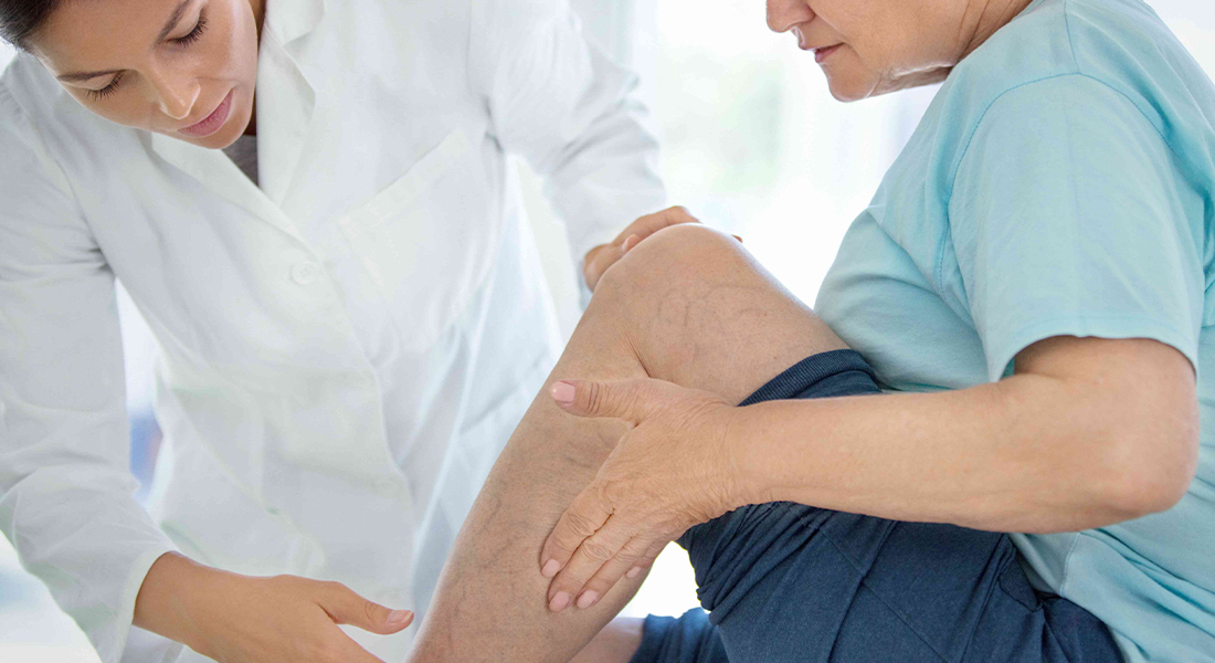 Treatment of Venous Diseases